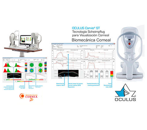 PENTACAM HR equipment for keratoconus diagnosis in Bogotá