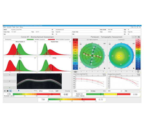 Corvis ST for corneal stiffness measurement and intraocular pressure in Bogotá