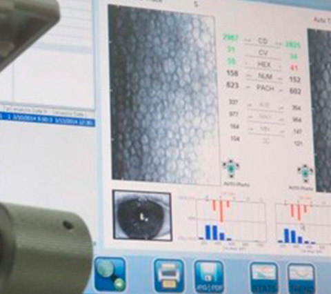 Specular microscopy equipment