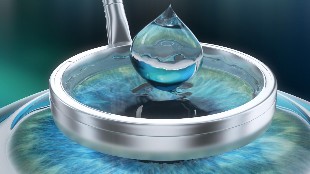 PRK - Photorefractive keratectomy in Bogotá